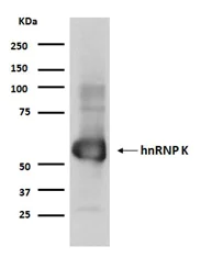 Immunoprecipitation - Anti-hnRNP K antibody [EP943Y] - BSA and Azide free (AB220996)