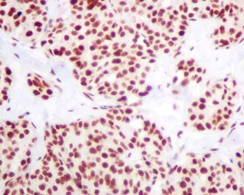 Immunohistochemistry (Formalin/PFA-fixed paraffin-embedded sections) - Anti-hnRNP K antibody [EPR10933] - BSA and Azide free (AB249265)