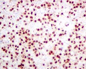 Immunohistochemistry (Formalin/PFA-fixed paraffin-embedded sections) - Anti-hnRNP K antibody [EPR10933] - BSA and Azide free (AB249265)