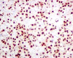 Immunohistochemistry (Formalin/PFA-fixed paraffin-embedded sections) - Anti-hnRNP K antibody [EPR10933] - BSA and Azide free (AB249265)