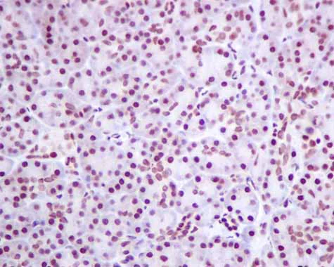 Immunohistochemistry (Formalin/PFA-fixed paraffin-embedded sections) - Anti-hnRNP K antibody [EPR10933] - BSA and Azide free (AB249265)