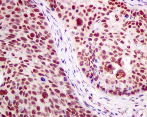 Immunohistochemistry (Formalin/PFA-fixed paraffin-embedded sections) - Anti-hnRNP K antibody [EPR10933] - BSA and Azide free (AB249265)