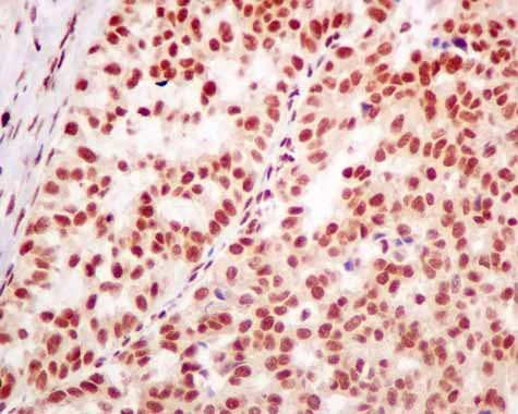 Immunohistochemistry (Formalin/PFA-fixed paraffin-embedded sections) - Anti-hnRNP K antibody [EPR10933] - BSA and Azide free (AB249265)