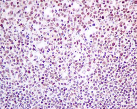 Immunohistochemistry (Formalin/PFA-fixed paraffin-embedded sections) - Anti-hnRNP K antibody [EPR10933] - BSA and Azide free (AB249265)
