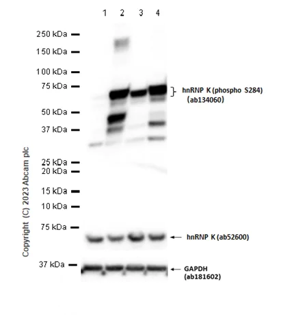 Western blot - Anti-hnRNP K antibody [EPR944] (phospho S284) - BSA and Azide free (AB248664)