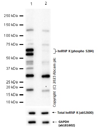 Western blot - Anti-hnRNP K antibody [EPR944] (phospho S284) - BSA and Azide free (AB248664)