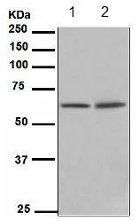 Western blot - Anti-hnRNP K antibody [EPR944] (phospho S284) - BSA and Azide free (AB248664)
