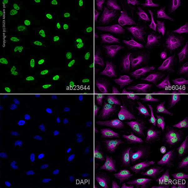Immunocytochemistry/ Immunofluorescence - Anti-hnRNP K antibody [F45 P9 C7] (AB23644)