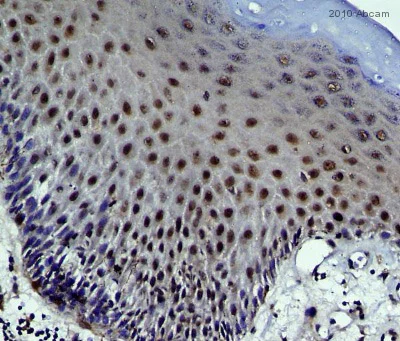 Immunohistochemistry (Formalin/PFA-fixed paraffin-embedded sections) - Anti-hnRNP K antibody [F45 P9 C7] (AB23644)