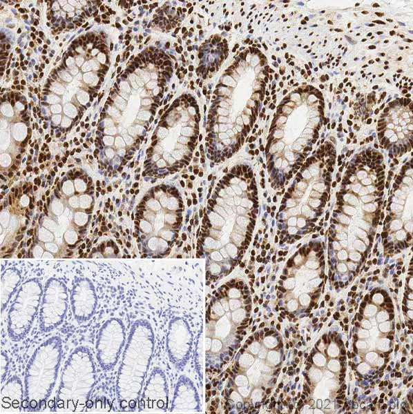 Immunohistochemistry (Formalin/PFA-fixed paraffin-embedded sections) - Anti-hnRNP K antibody [F45 P9 C7] (AB23644)