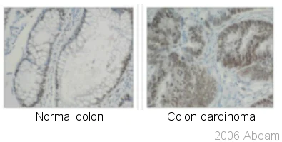 Immunohistochemistry (Formalin/PFA-fixed paraffin-embedded sections) - Anti-hnRNP K antibody [F45 P9 C7] (AB23644)