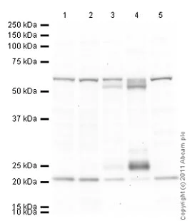 Western blot - Anti-hnRNP K antibody [F45 P9 C7] (AB23644)