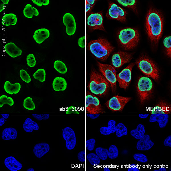 Immunocytochemistry/ Immunofluorescence - Anti-hnRNP K antibody [RM1055] - BSA and Azide free (AB315099), expandable thumbnail