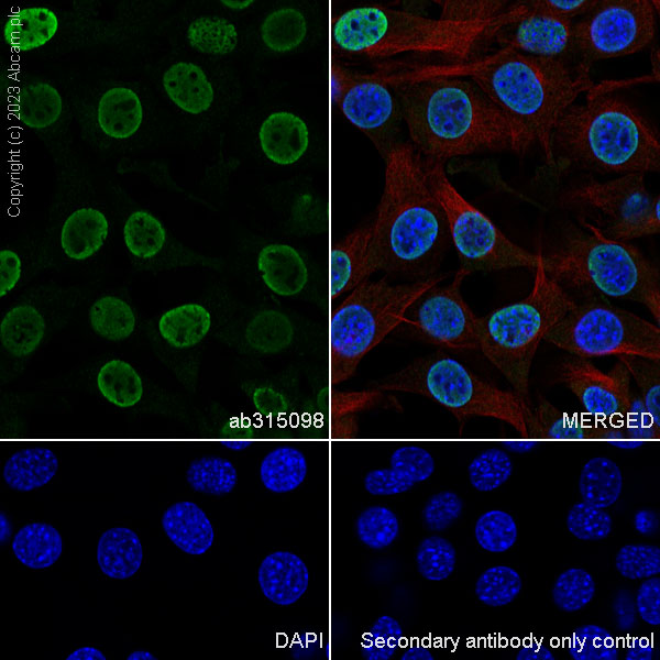 Immunocytochemistry/ Immunofluorescence - Anti-hnRNP K antibody [RM1055] - BSA and Azide free (AB315099), expandable thumbnail