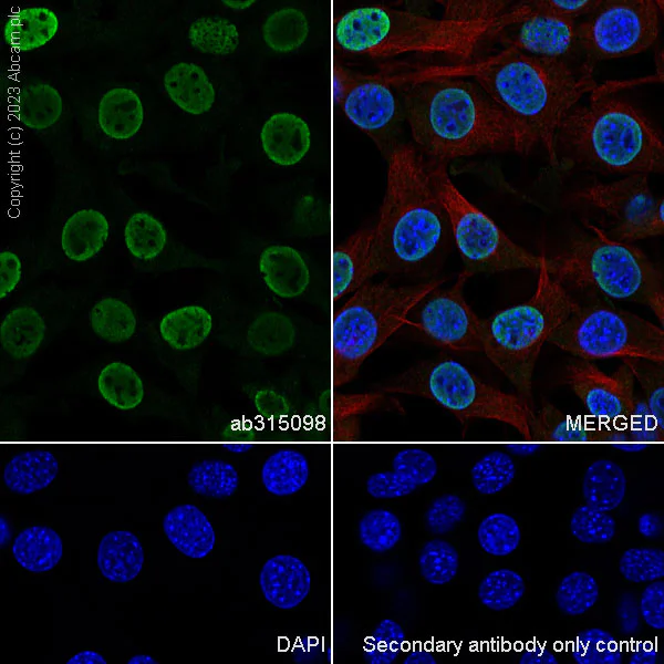 Immunocytochemistry/ Immunofluorescence - Anti-hnRNP K antibody [RM1055] - BSA and Azide free (AB315099)
