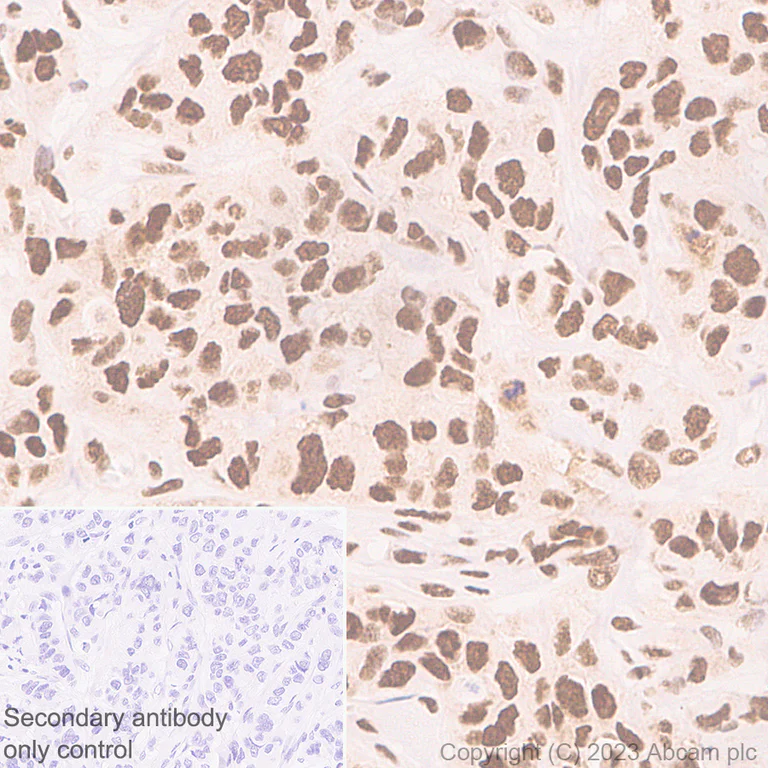 Immunohistochemistry (Formalin/PFA-fixed paraffin-embedded sections) - Anti-hnRNP K antibody [RM1055] - BSA and Azide free (AB315099)