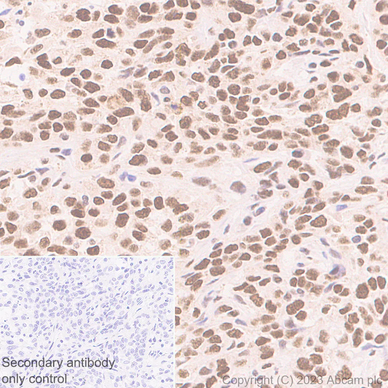 Immunohistochemistry (Formalin/PFA-fixed paraffin-embedded sections) - Anti-hnRNP K antibody [RM1055] - BSA and Azide free (AB315099)