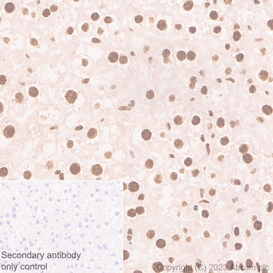 Immunohistochemistry (Formalin/PFA-fixed paraffin-embedded sections) - Anti-hnRNP K antibody [RM1055] - BSA and Azide free (ab315099), expandable thumbnail