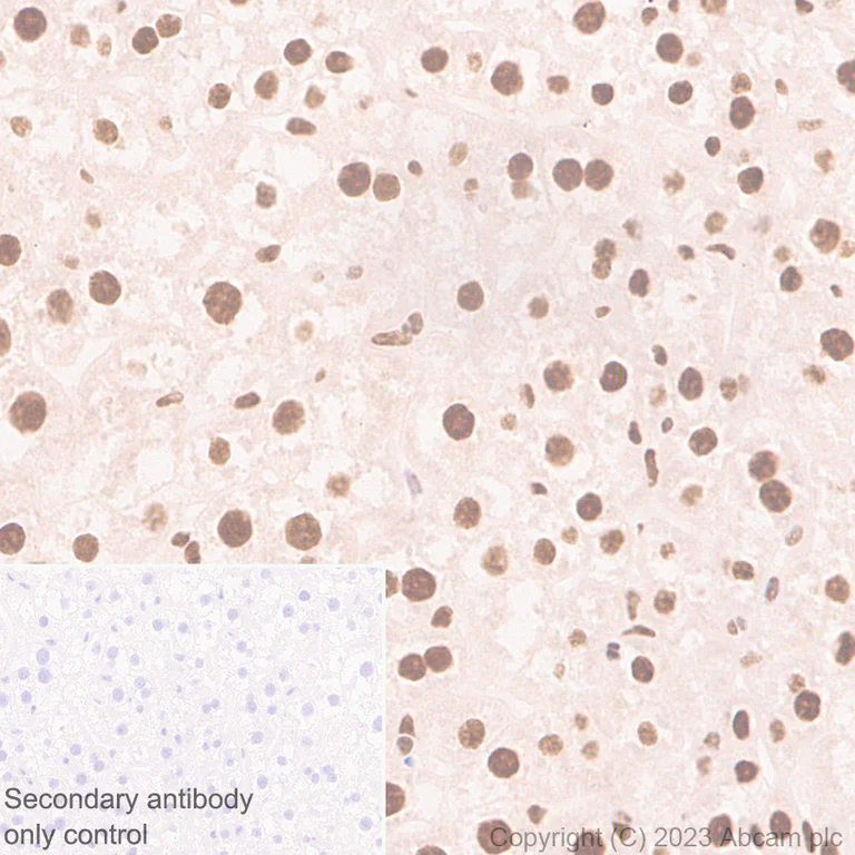 Immunohistochemistry (Formalin/PFA-fixed paraffin-embedded sections) - Anti-hnRNP K antibody [RM1055] - BSA and Azide free (AB315099)