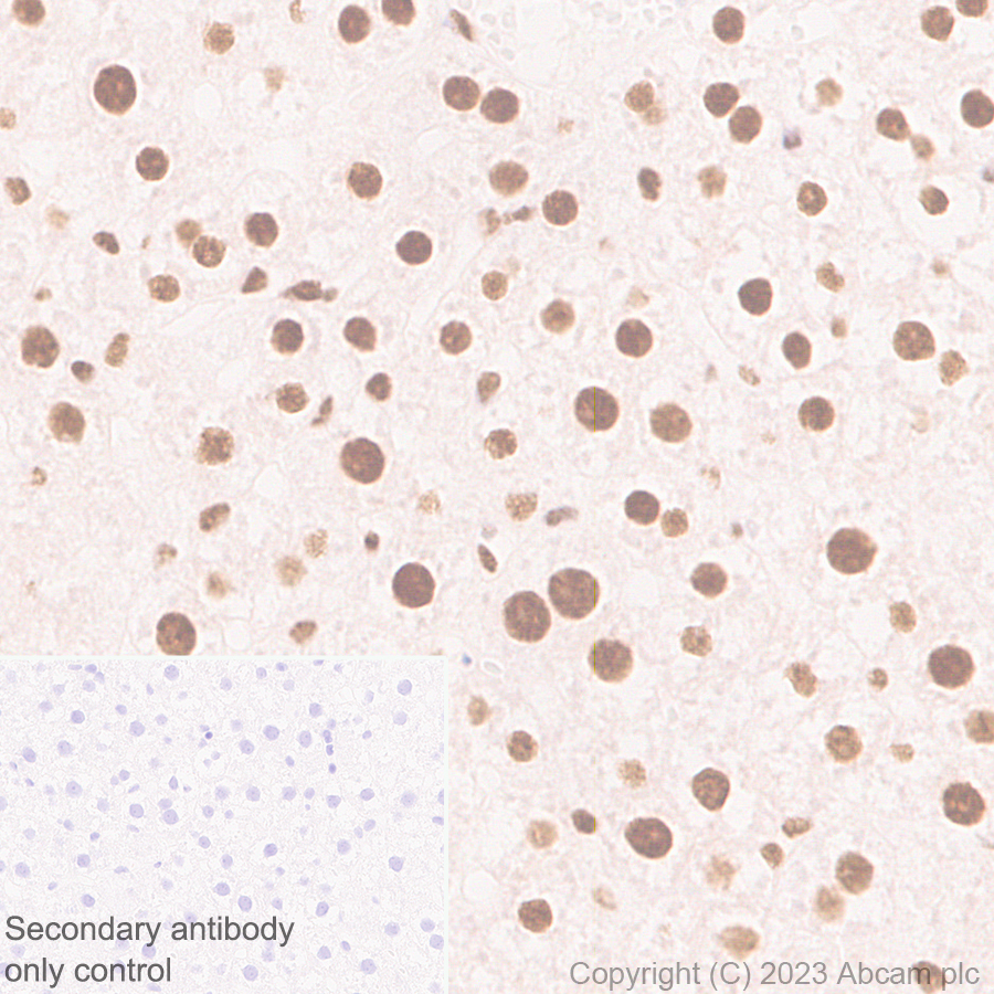 Immunohistochemistry (Formalin/PFA-fixed paraffin-embedded sections) - Anti-hnRNP K antibody [RM1055] - BSA and Azide free (AB315099), expandable thumbnail