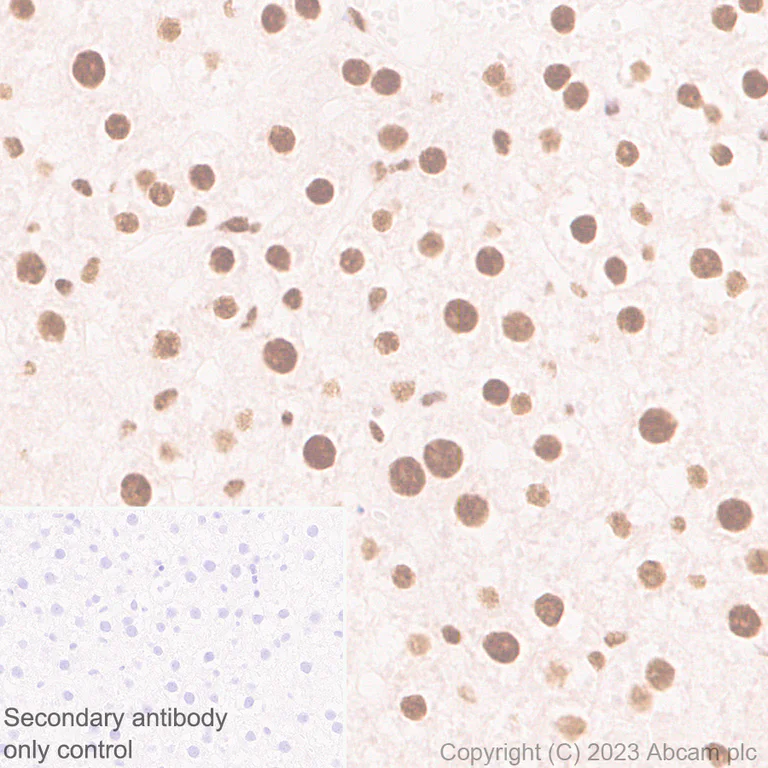 Immunohistochemistry (Formalin/PFA-fixed paraffin-embedded sections) - Anti-hnRNP K antibody [RM1055] - BSA and Azide free (AB315099)