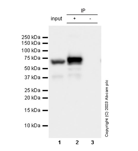 Immunoprecipitation - Anti-hnRNP K antibody [RM1055] - BSA and Azide free (ab315099), expandable thumbnail