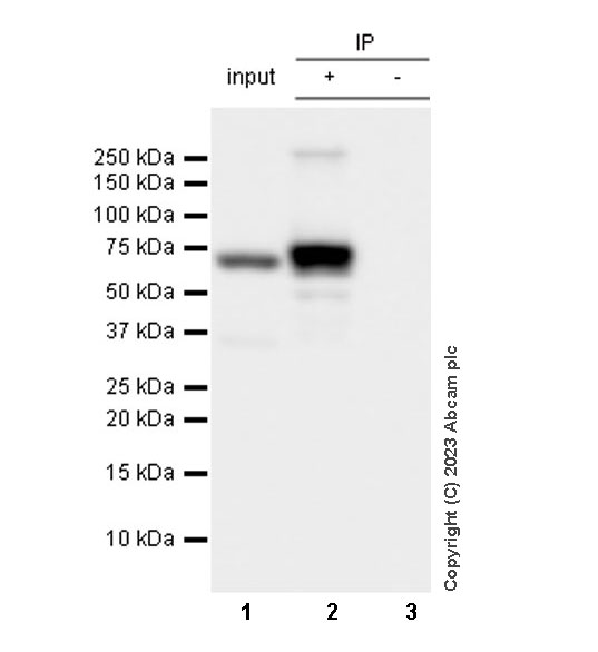Immunoprecipitation - Anti-hnRNP K antibody [RM1055] - BSA and Azide free (ab315099), expandable thumbnail