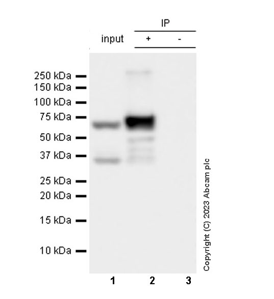 Immunoprecipitation - Anti-hnRNP K antibody [RM1055] - BSA and Azide free (ab315099), expandable thumbnail
