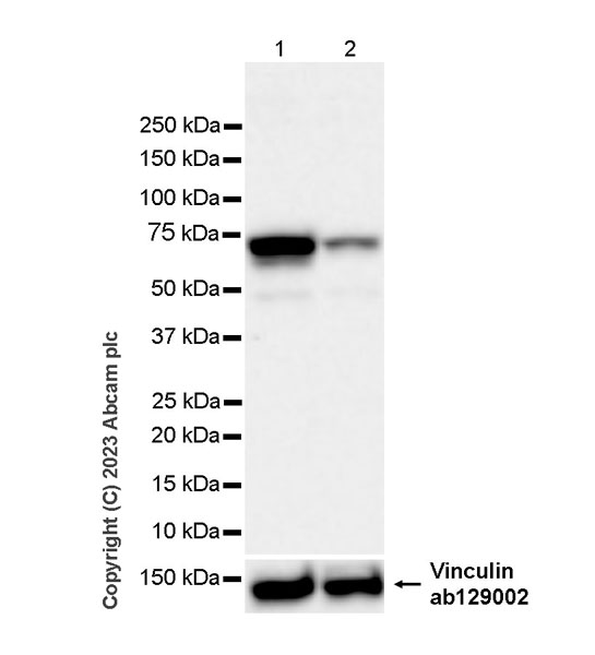 Western blot - Anti-hnRNP K antibody [RM1055] - BSA and Azide free (ab315099), expandable thumbnail