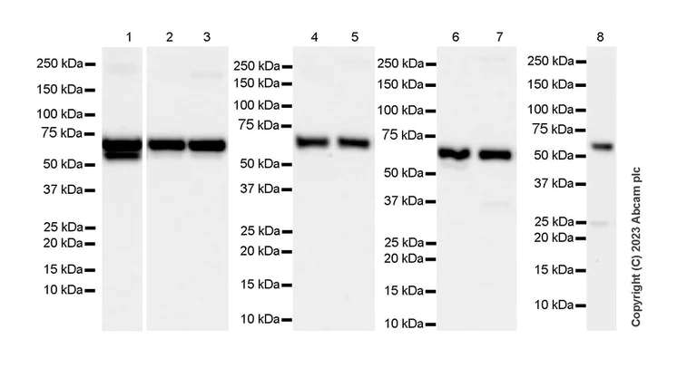 Western blot - Anti-hnRNP K antibody [RM1055] - BSA and Azide free (AB315099)