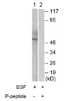 Western blot - Anti-hnRNP K (phospho S284) antibody (AB74066)