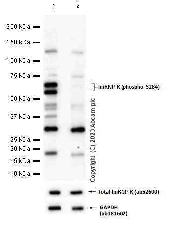 Western blot - Anti-hnRNP K (phospho S284) antibody [EPR944] (AB134060)