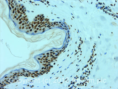 Immunohistochemistry (Formalin/PFA-fixed paraffin-embedded sections) - Anti-hnRNP L antibody [4D11] (AB6106), expandable thumbnail