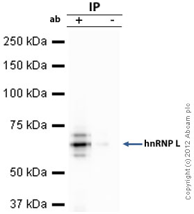 Immunoprecipitation - Anti-hnRNP L antibody [4D11] (AB6106), expandable thumbnail