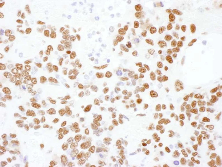 Immunohistochemistry (Formalin/PFA-fixed paraffin-embedded sections) - Anti-hnRNP L antibody (AB264340)