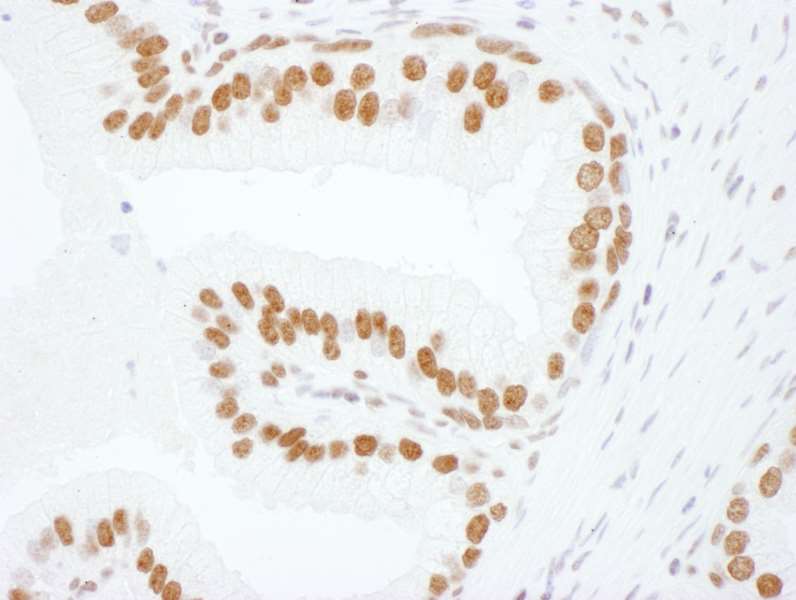 Immunohistochemistry (Formalin/PFA-fixed paraffin-embedded sections) - Anti-hnRNP L antibody (AB264340)