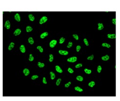 Immunocytochemistry/ Immunofluorescence - Anti-hnRNP M1-M4 antibody [EPR13509(B)] (AB177957)