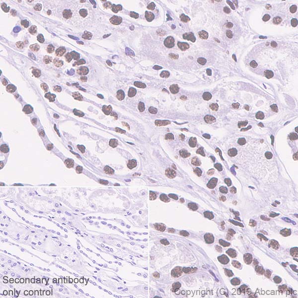 Immunohistochemistry (Formalin/PFA-fixed paraffin-embedded sections) - Anti-hnRNP M1-M4 antibody [EPR13509(B)] (AB177957)