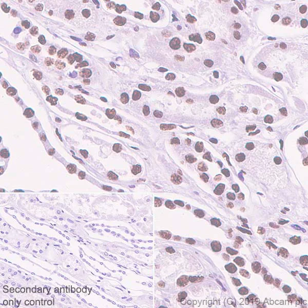 Immunohistochemistry (Formalin/PFA-fixed paraffin-embedded sections) - Anti-hnRNP M1-M4 antibody [EPR13509(B)] (AB177957)