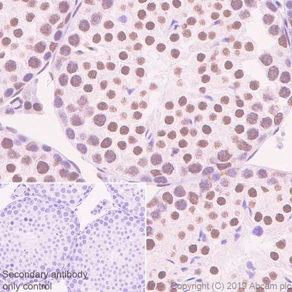 Immunohistochemistry (Formalin/PFA-fixed paraffin-embedded sections) - Anti-hnRNP M1-M4 antibody [EPR13509(B)] (AB177957)