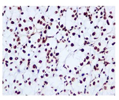 Immunohistochemistry (Formalin/PFA-fixed paraffin-embedded sections) - Anti-hnRNP M1-M4 antibody [EPR13509(B)] (AB177957)