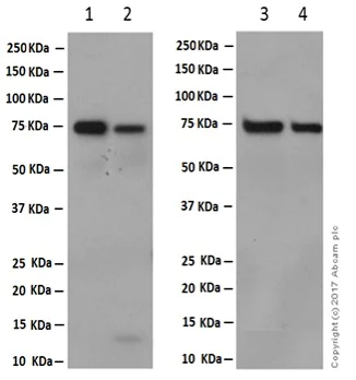 Western blot - Anti-hnRNP M1-M4 antibody [EPR13509(B)] (AB177957)