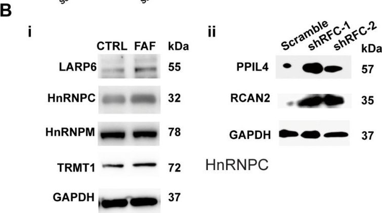 Western blot - Anti-hnRNP M1-M4 antibody [EPR13509(B)] (AB177957)