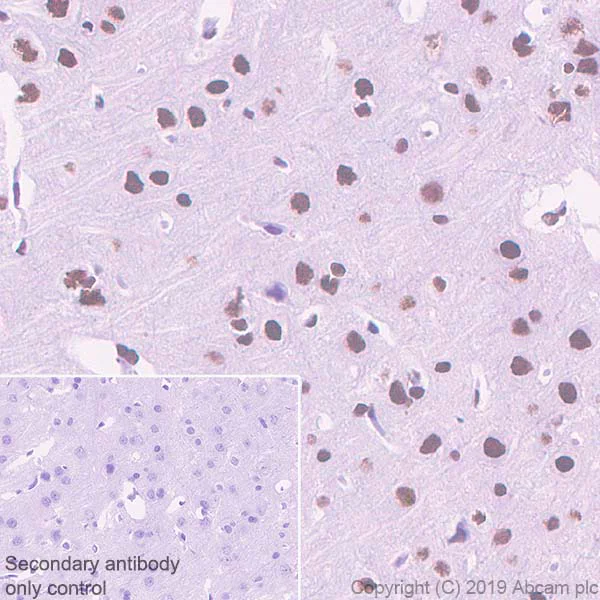 Immunohistochemistry (Formalin/PFA-fixed paraffin-embedded sections) - Anti-hnRNP M1-M4 antibody [EPR13509(B)] - BSA and Azide free (AB250027)