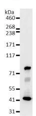 Immunoprecipitation - Anti-hnRNP M3-M4 antibody [2A6-2H3] (AB128143)