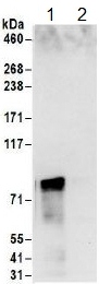 Immunoprecipitation - Anti-hnRNP M3-M4 antibody (AB157100)