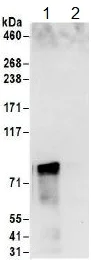 Immunoprecipitation - Anti-hnRNP M3-M4 antibody (AB157100)
