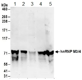 Western blot - Anti-hnRNP M3-M4 antibody (AB157100)