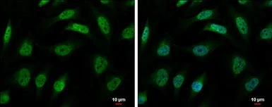 Immunocytochemistry/ Immunofluorescence - Anti-hnRNP R antibody (AB151251)
