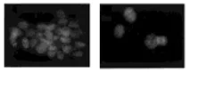 Immunocytochemistry/ Immunofluorescence - Anti-hnRNP U/p120 antibody (AB122906)